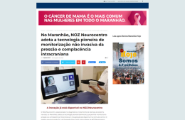 <h6><a href="https://maranhaohoje.com/no-maranhao-noz-neurocentro-adota-a-tecnologia-pioneira-de-monitorizacao-nao-invasiva-da-pressao-e-complacencia-intracraniana/" target="_blank" rel="noopener">No Maranhão, NOZ Neurocentro adota a tecnologia pioneira de monitorização não invasiva da pressão e complacência intracraniana</a></h6><p><a href="https://maranhaohoje.com/no-maranhao-noz-neurocentro-adota-a-tecnologia-pioneira-de-monitorizacao-nao-invasiva-da-pressao-e-complacencia-intracraniana/" target="_blank" rel="noopener">Maranhão Hoje</a></p>
