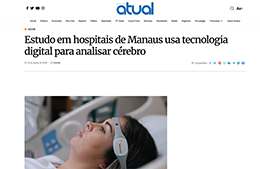 <h6><a href="https://amazonasatual.com.br/estudo-em-hospitais-de-manaus-usa-tecnologia-digital-para-analisar-cerebro/" target="_blank" rel="noopener">estudo em hospitais de Manaus usa tecnologia digital para analisar cérebro</a></h6><p><a href="https://amazonasatual.com.br/estudo-em-hospitais-de-manaus-usa-tecnologia-digital-para-analisar-cerebro/" target="_blank" rel="noopener">Amazonas Atual</a></p>